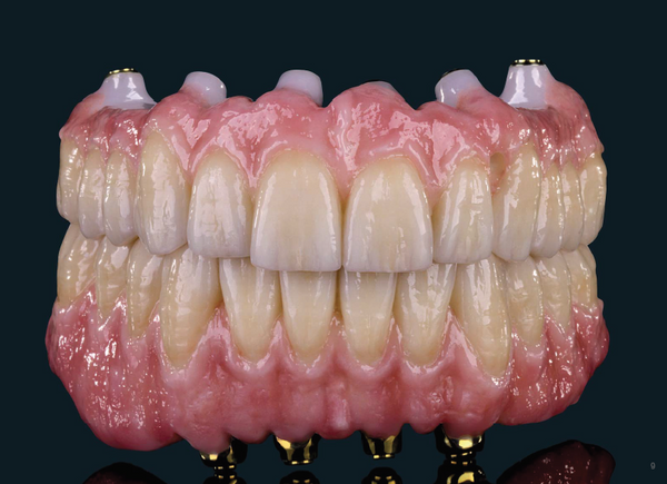 CAD/CAM Prettau® Zirconia Ø 95 mm